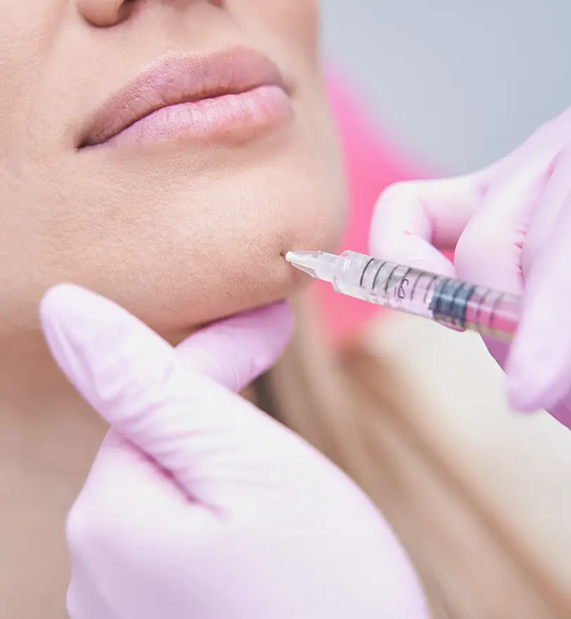 Injectables | chin fillers | Dr. Z Facial Plastic Surgery